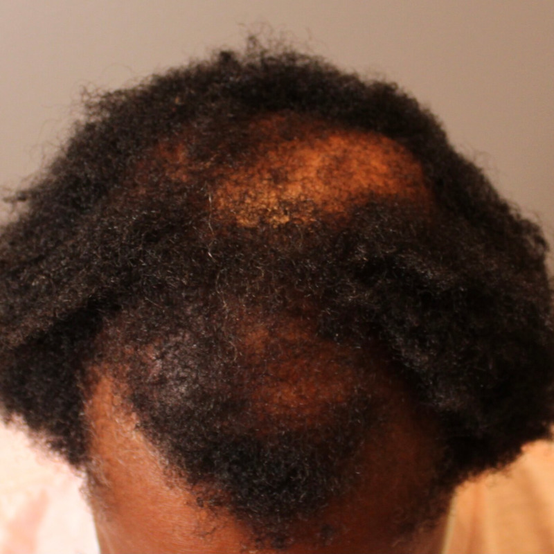 After Image