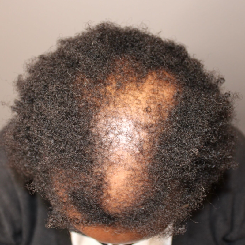 Before Image