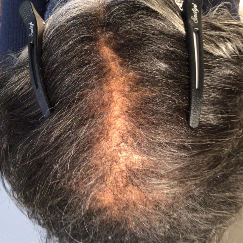 Before Image