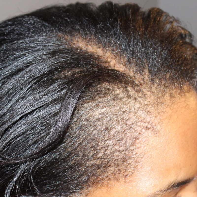 Before Image
