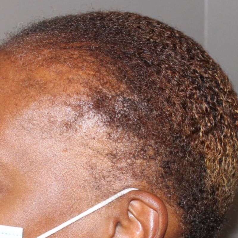 Before Image