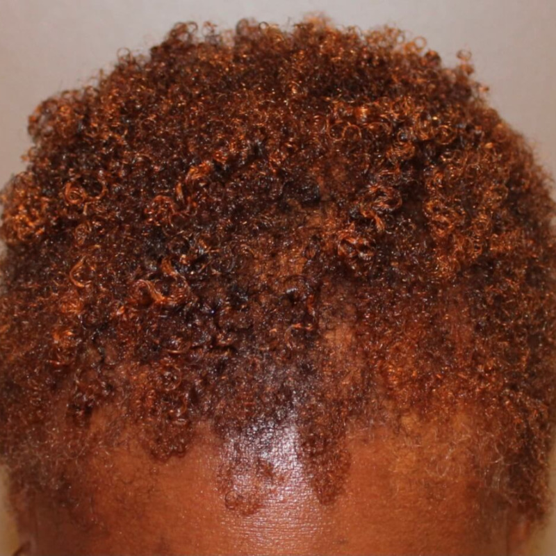After Image